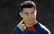 Ronaldo đến sân tập với khuôn mặt bầm tím
