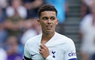HLV Tottenham: “Cậu ấy thật siêu đẳng” 