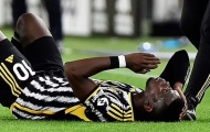 Địa ngục chấn thương của Pogba khiến Juventus khốn đốn
