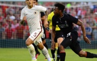 Daniel Sturridge lại khiến Liverpool đau đầu với chấn thương hông