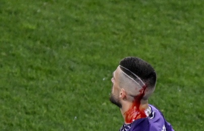  Sao Fiorentina bị CĐV ném chảy máu đầu ở chung kết Conference League 
